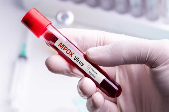 A hand holding a blood sample tube labeled 'MPox Virus Positive'