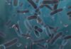 Legionnaires’ cluster grows on the Upper East Side