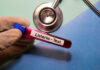 A gloved hand holding a blood test tube labeled 'Listeria - Test'