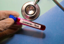 A gloved hand holding a blood test tube labeled 'Listeria - Test'