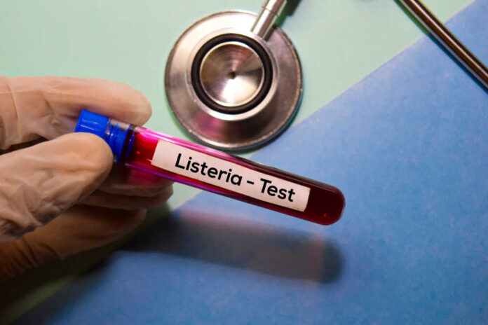 Listeria,-,Test,With,Blood,Sample.,Top,View,Isolated,On A gloved hand holding a blood test tube labeled 'Listeria - Test'