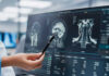 Doctor pointing at brain scans on a computer screen.