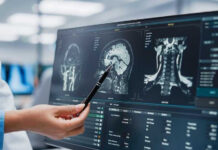 Doctor pointing at brain scans on a computer screen.